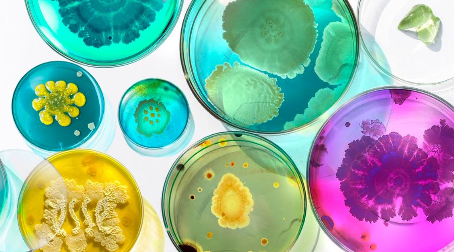 5 eri tapaa parantaa mikrobiomisi terveyttä