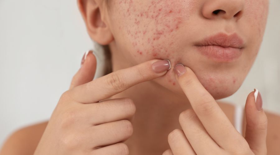 Finnit pois - mitä voin tehdä?