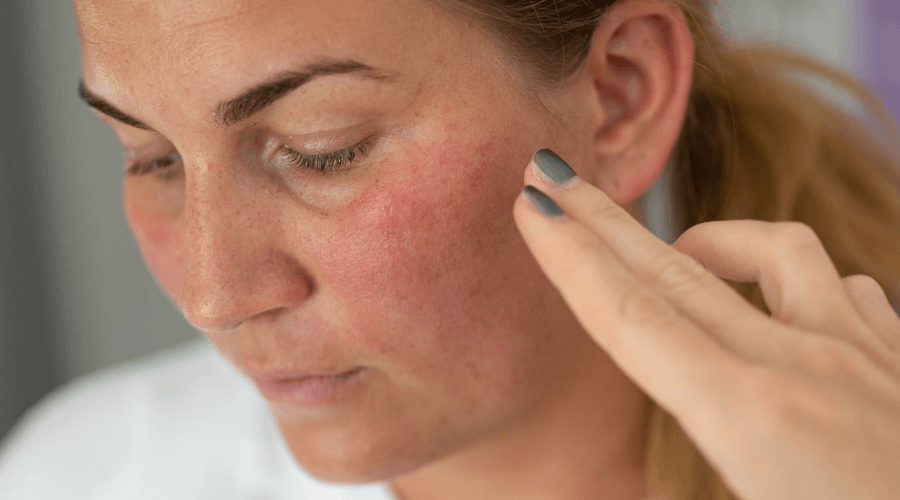 Ihon punoitus: parhaat raaka-aineet ja tuotteet