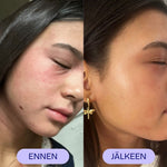 Kosteusvoide Flow Cosmetics Propolis & Probiotics Rescue Cream asiakas kuva ennen ja jälkeen