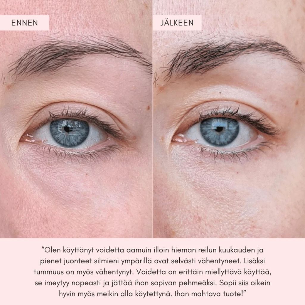 Flow Cosmetics Green Tea & Peptide Eye Cream silmänympärysvoide kuvat ennen ja jälkeen