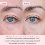 Flow Cosmetics Green Tea & Peptide Eye Cream silmänympärysvoide kuvat ennen ja jälkeen