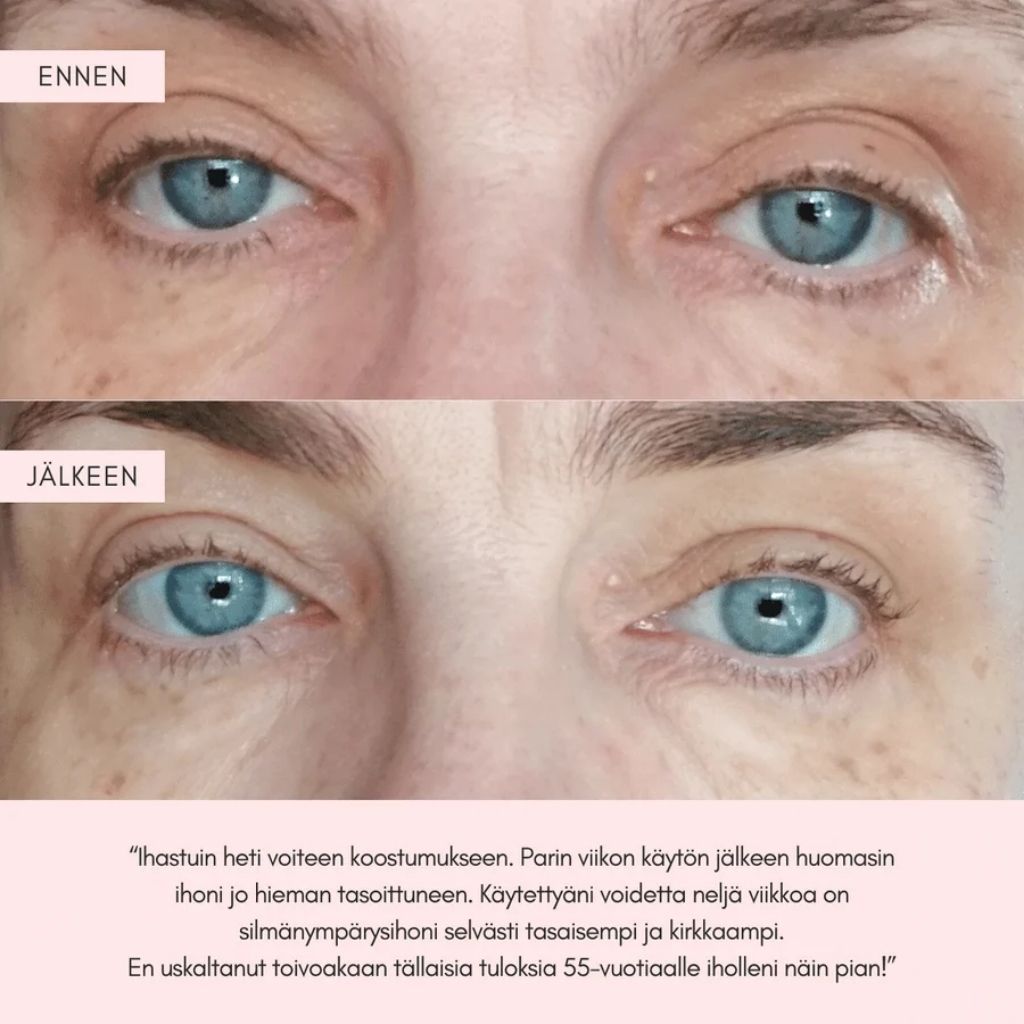 Flow Cosmetics Green Tea & Peptide Eye Cream silmänympärysvoide kuvat ennen ja jälkeen