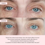Flow Cosmetics Green Tea & Peptide Eye Cream silmänympärysvoide kuvat ennen ja jälkeen
