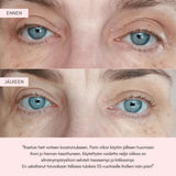 Flow Cosmetics Green Tea & Peptide Eye Cream silmänympärysvoide kuvat ennen ja jälkeen